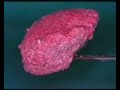 Complete flapless lift