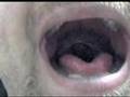 CPAP Continuous Positive Airway Pressure