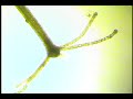 A live video capture of a Hyrda using the bright field mircoscope technique.
