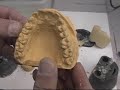 Hydrocolloid Duplication and Articulating