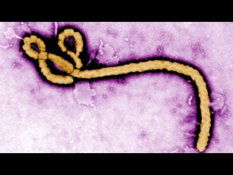 Ebola Outbreak: Spend, Spend, Spend to Fight It Says Jeffrey Sachs