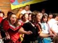 Down syndrome:&nbsp;Down Syndrome: Alex in Grease
