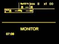 ekg