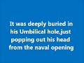 Clean Your Umbilicus (Naval Belly) Properly Or You may Face this In Your Belly Button