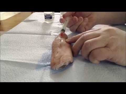 how to administer lidocaine injection