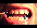 Pete and the Pirates - Mr Understanding