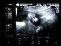 videos de New Moncayo member family 4
