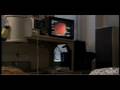 Katie Couric's Colonoscopy for SU2C