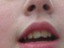 Thumbnail #1
