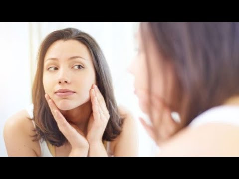 how to treat tca chemical burn