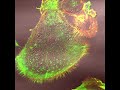 Fluorescent Confocal Microscopy Fluorescent Confocal Microscopy