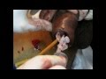 Priapism Treatment.wmv