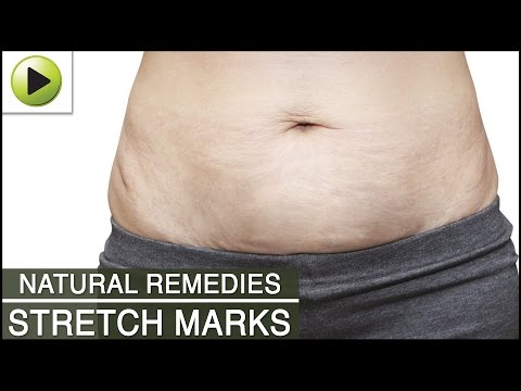Skin Care - Stretch Marks - Natural Ayurvedic Home Remedies