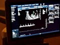 hear the baby\