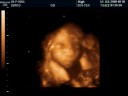 Kivan's baby