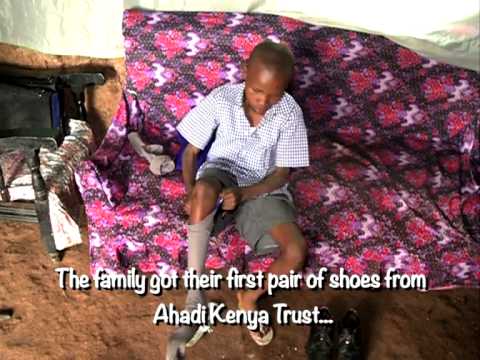 how to treat jigger infestation