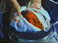 Secret Life: Jeffrey Dahmer clip Secret Life: Jeffrey Dahmer clip