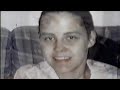 the face of meth  part 2   warning graphic