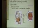 Sleep Apnea_6 Sleep Apnea_6
