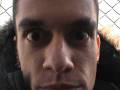 ojos saltones