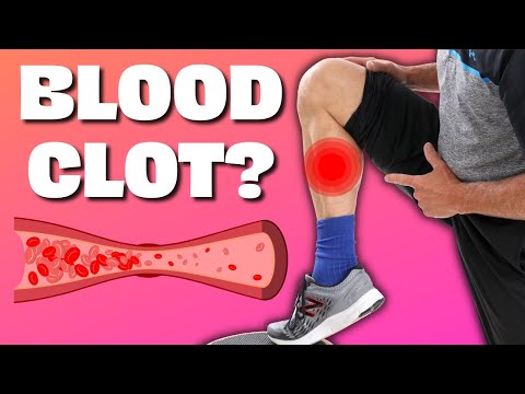 how to discover blood clot