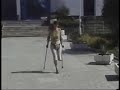 russian amputee