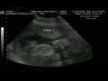 videos de Victória Angelo Cruz 1.wmv