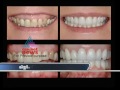Dental Care-Doctor Live Nov 23, Part 2 from Health Arogyam Dental Care-Doctor Live Nov 23, Part 2