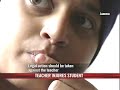 teacher-slaps-student-ruptures-eardrums.html
