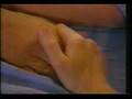 Pallidotomy-Part-2