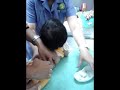 Chicken Pox Vaccination Varicella Virus Vaccine