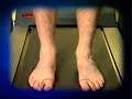Bunions www.footkneepain.com.au