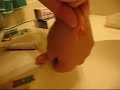 drain da cyst.mp4