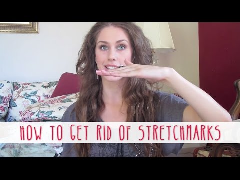 how to get rid stretch marks