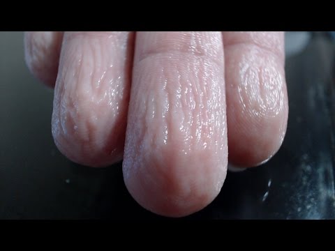 how to recover epidermis