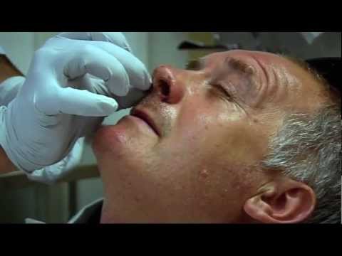 how to stop a huge nose bleed