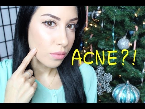 how to do you get acne