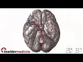 Insidermedicine in 60 - November 8, 2007
