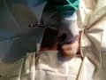 Incisi�n de la piel para uretrotom�a