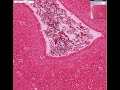 Histopathology-Brain