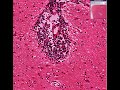 Histopathology-Brain