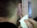 Puss and blood and a huge boil on his ear