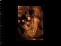 jj at 27 weeks and 5 days