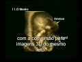 IVG e modernidade IVG e modernidade