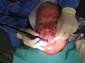 Medicine: Bill to the Dental Hygienist Medicine: Bill to the Dental Hygienist