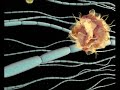 Esclerosis M�ltiple