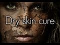 HOW TO: CURE DRY SKIN!!!!
