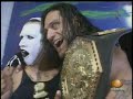 Ante El Regreso del Vampiro Canadiense Ante El Regreso del Vampiro Canadiense