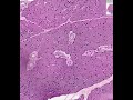 Shotgun Histology Parotid Gland Shotgun Histology Parotid Gland