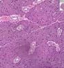 Shotgun Histology Parotid Gland
